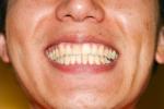 braces-0366.jpg